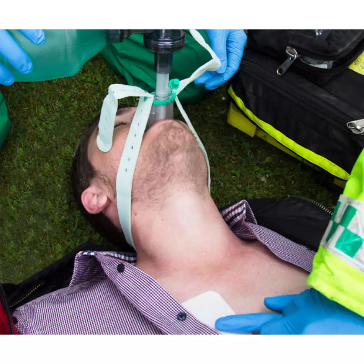  i-gel O2 Resus Larynxmaske im Set